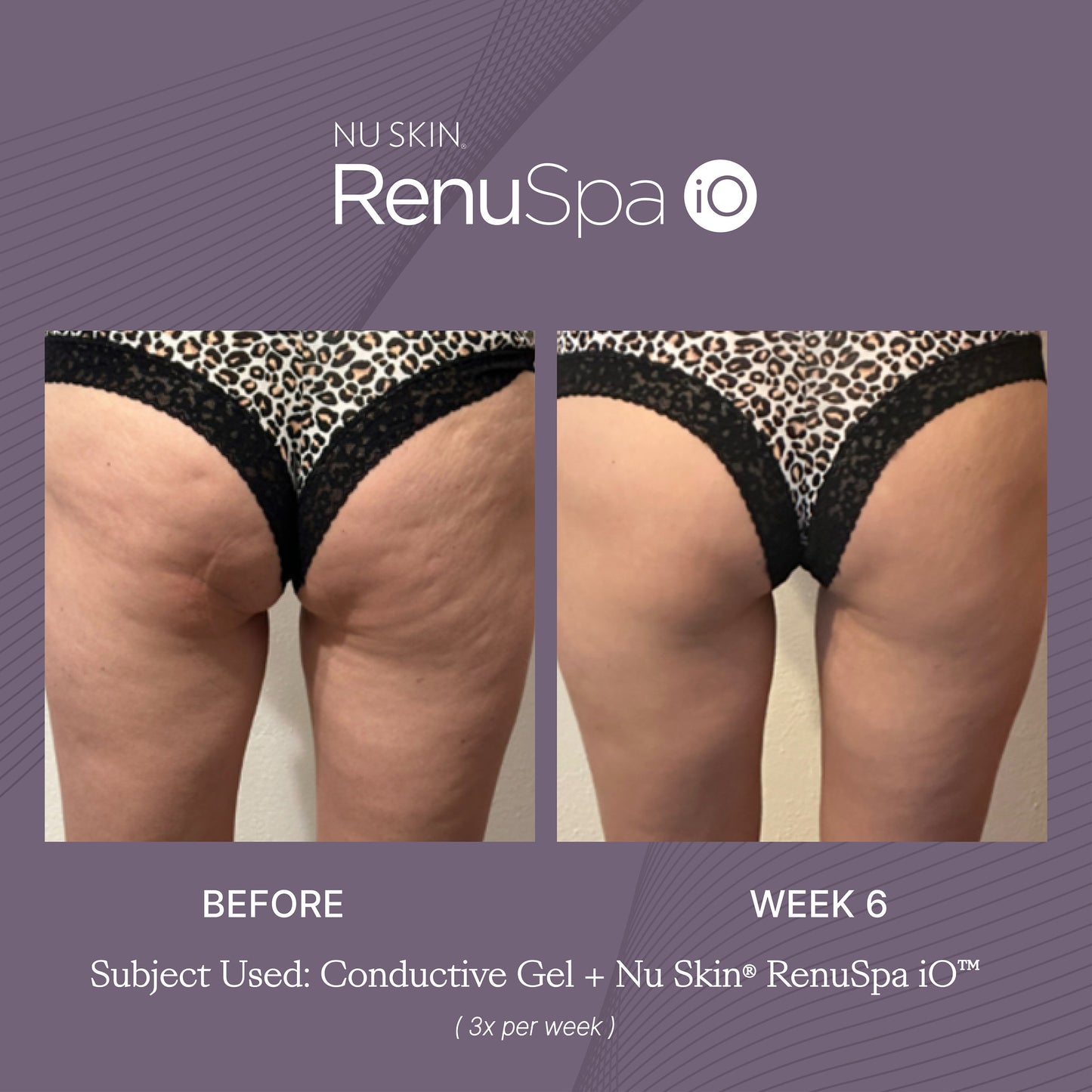 Nu Skin® RenuSpa iO™