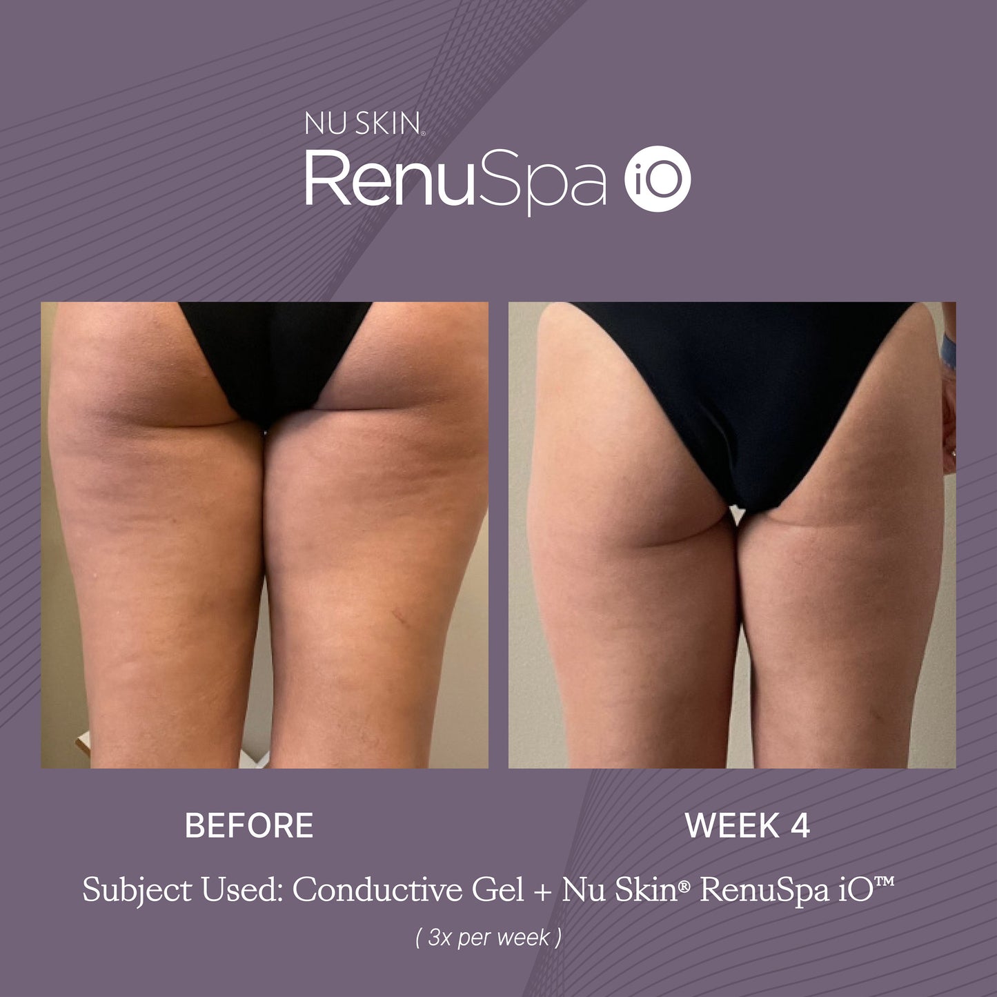 Nu Skin® RenuSpa iO™